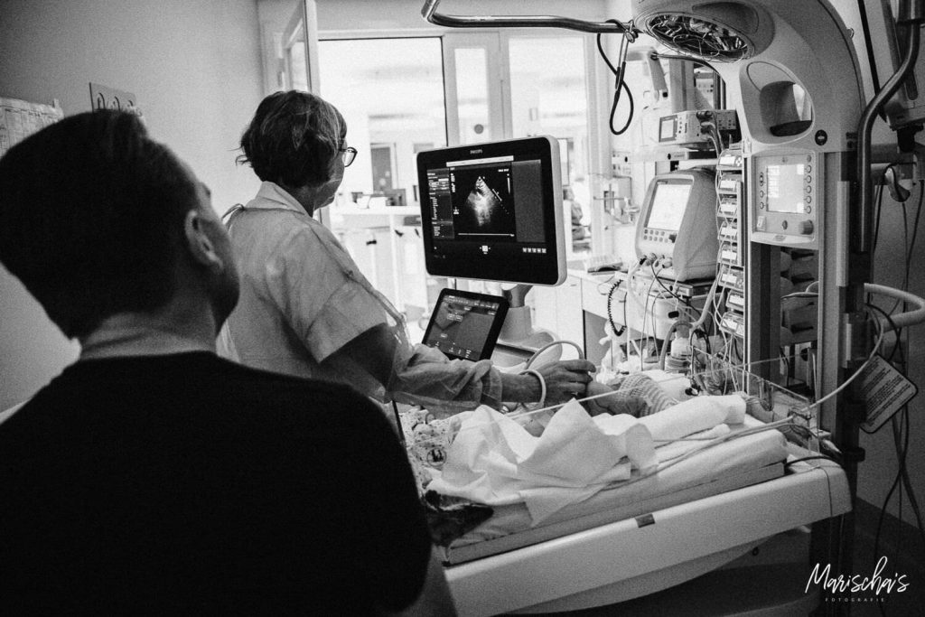 Geboortefotograaf voor een keizersnede van een vrouw dat gaat bevallen in het ziekenhuis UZ Leuven