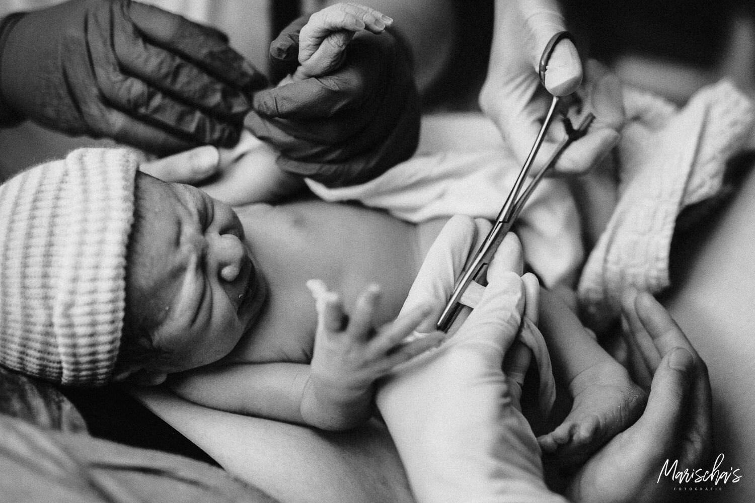 Geboortefotograaf voor een geboortereportage van een geboorte in het MMC ziekenhuis in brabant