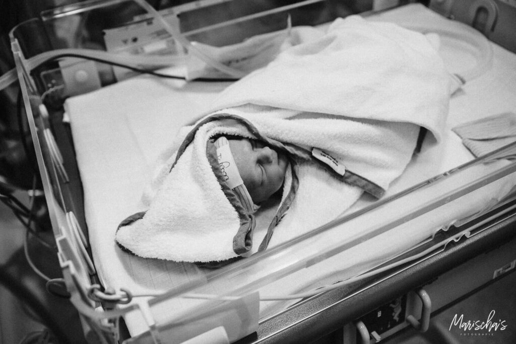 De bevalling via een keizersnede van een tweeling met foto's gemaakt door een bevallingsfotograaf.