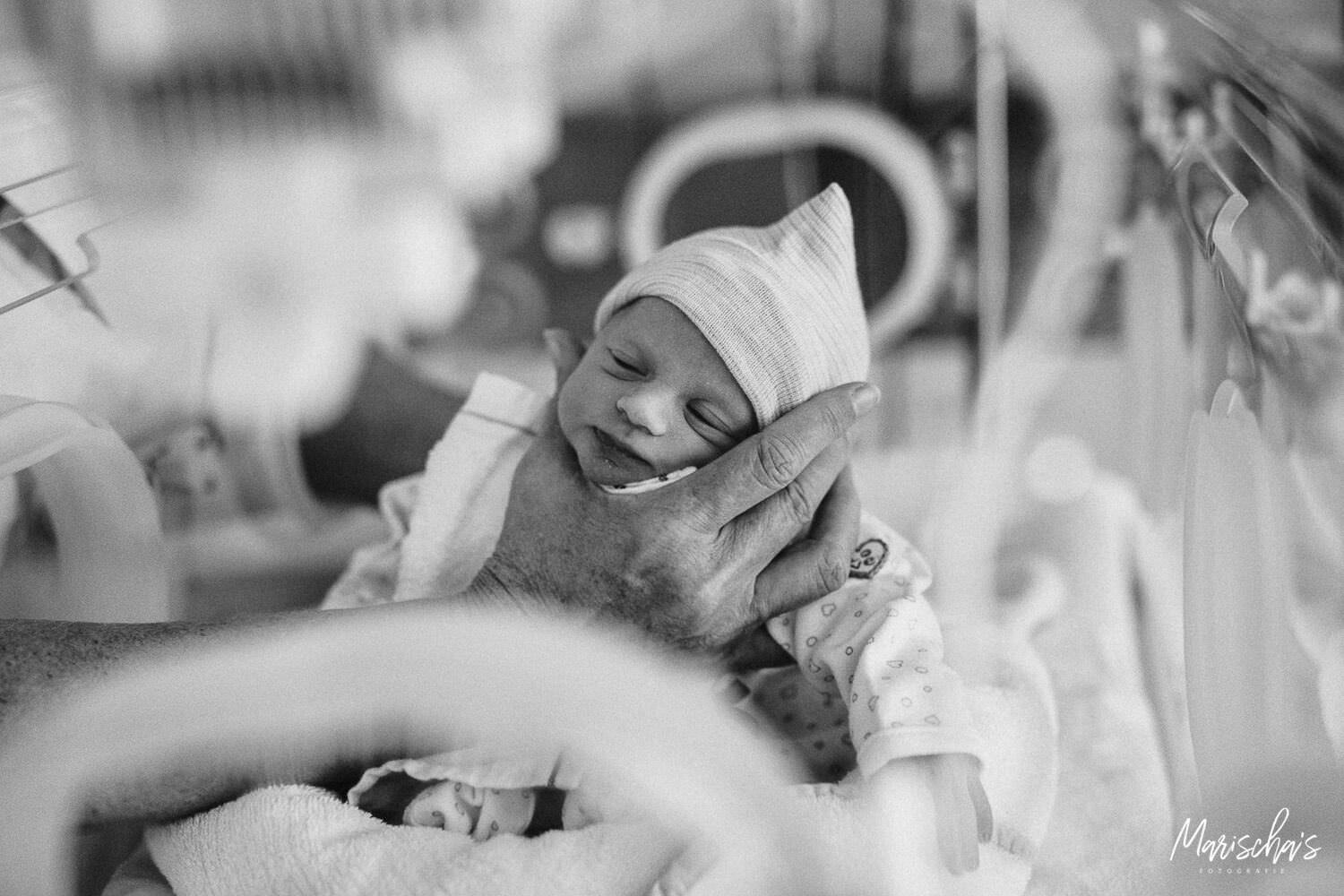 De bevalling via een keizersnede van een tweeling met foto's gemaakt door een bevallingsfotograaf.